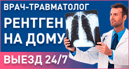 Рентген на дому