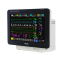 Модульный монитор пациента IntelliVue MX550