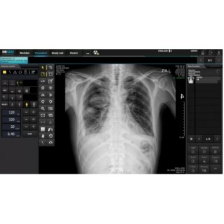 Рентгенодиагностическая система Redikom