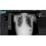 Цифровая рентгеновская система Redikom Premium