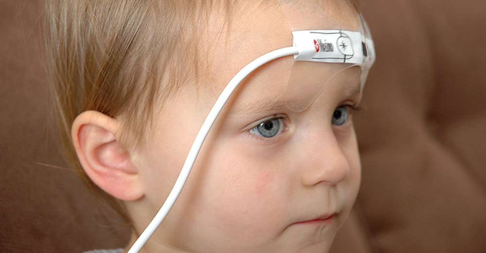 Пульсоксиметры на голову