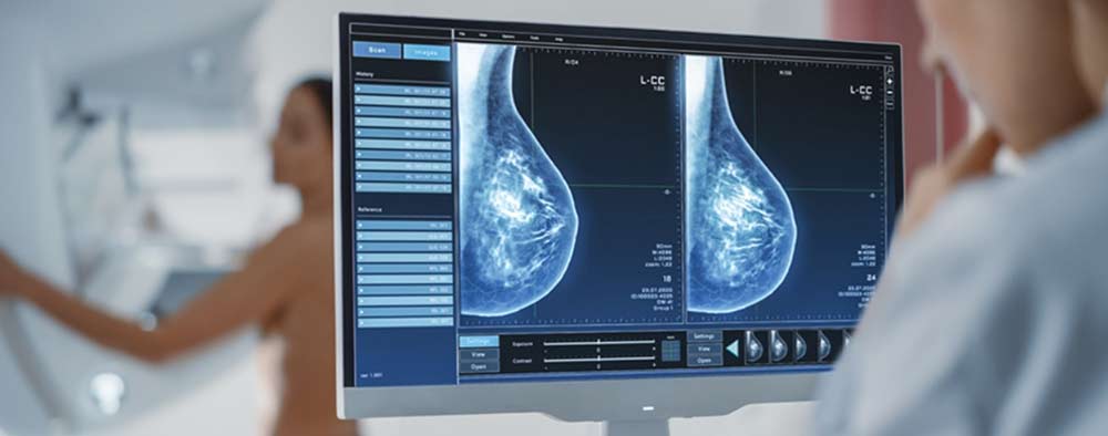 Маммографы