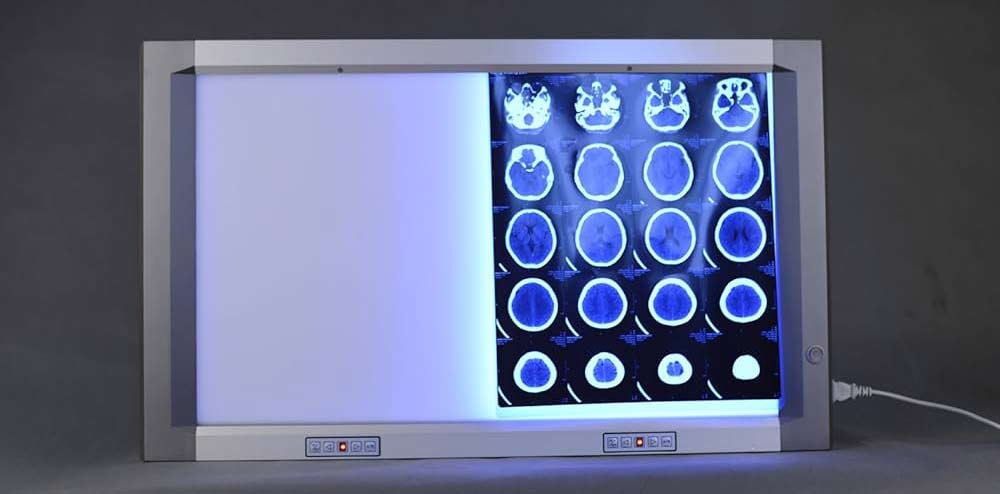 Медицинские негатоскопы